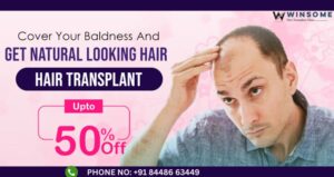 Hair transplant in noida