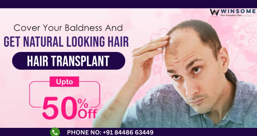 Hair transplant in noida