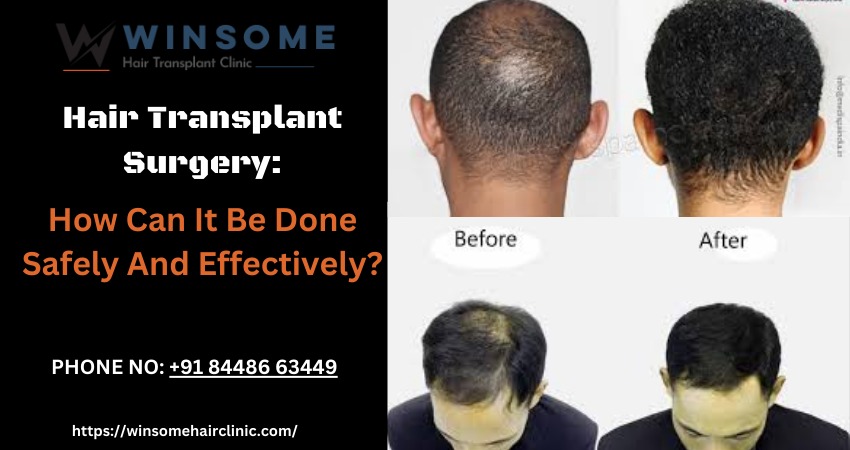 Hair Transplant Surgery: How Can It Be Done Safely And Effectively?
