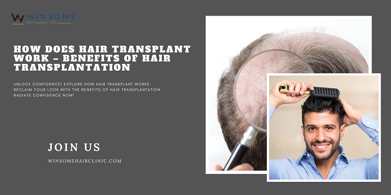 Hair Transplant Work