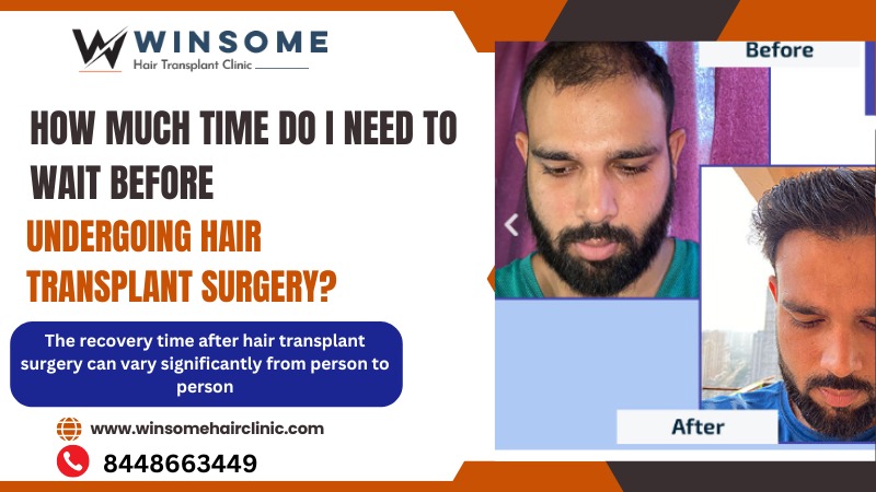 hair transplant in noida sector 18