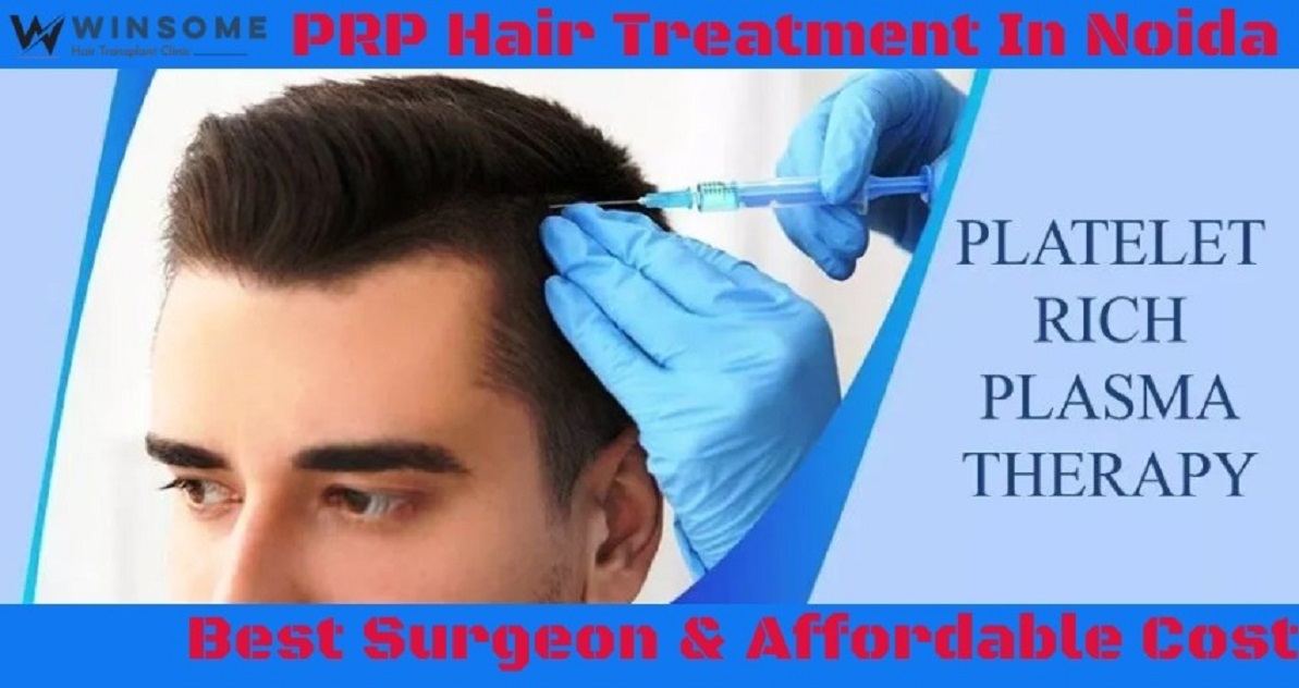 PRP hair treatment