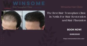 hair transplant clinic in Noida