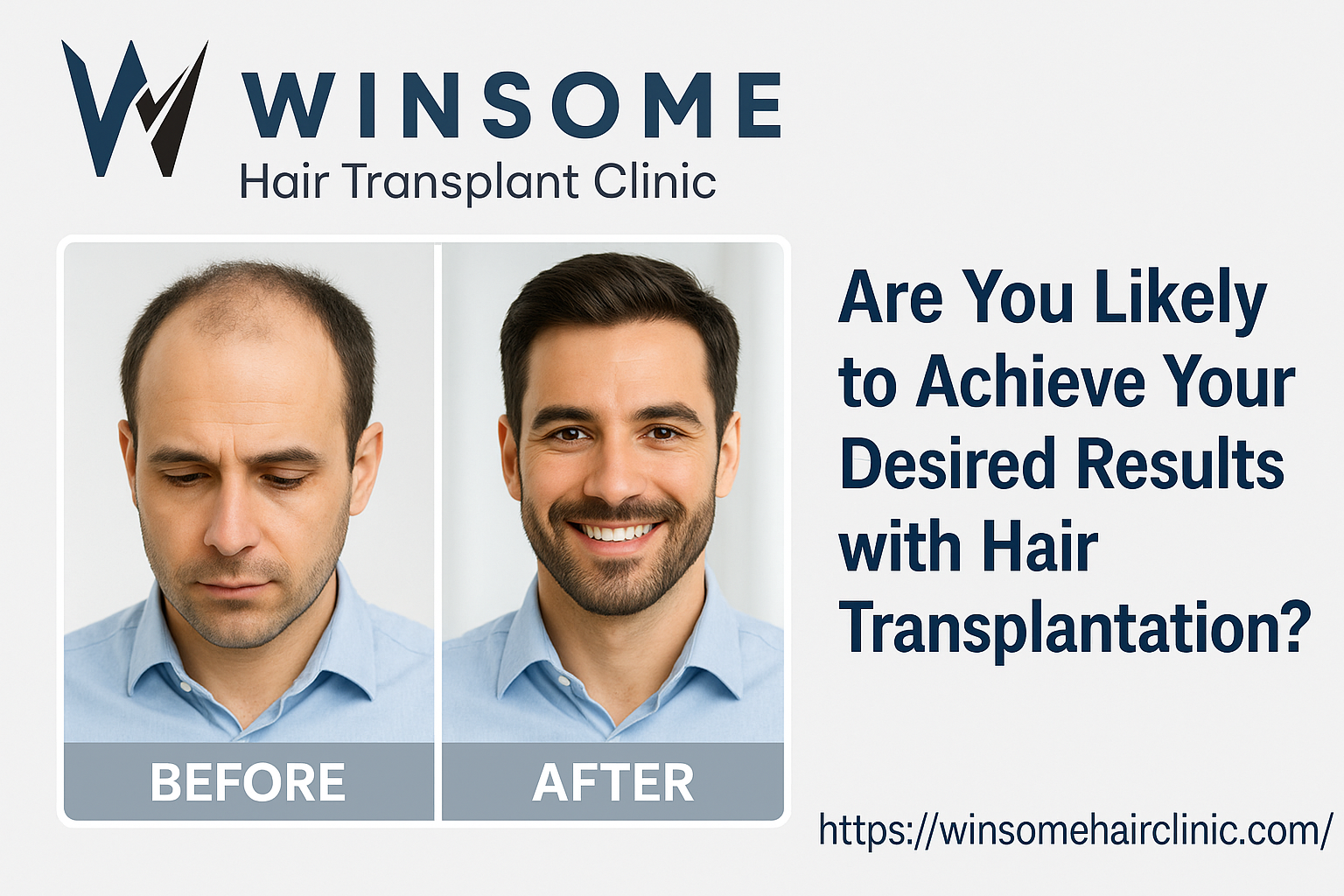 hair transplant