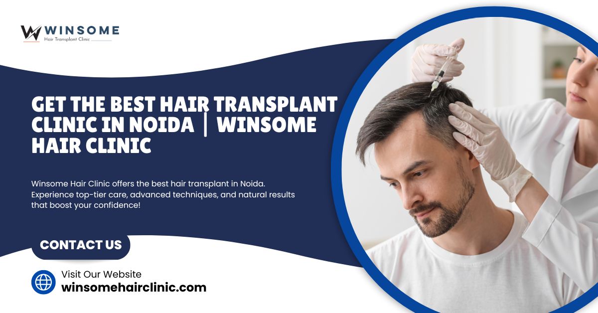 hair transplant clinic in Noida
