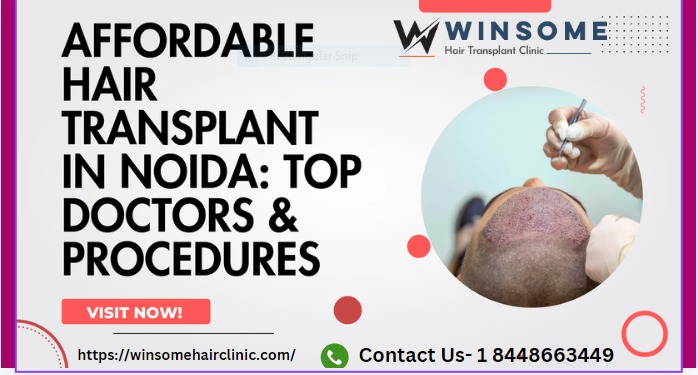 hair transplant doctor in Noida