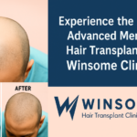 Hair Transplant