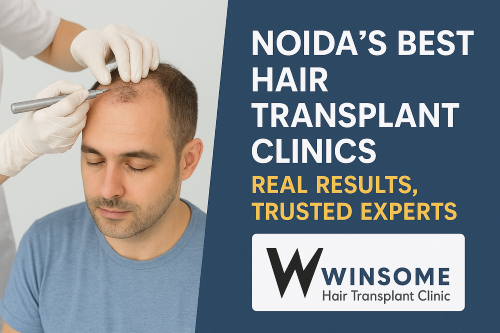 Hair Transplant Clinics
