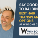 Best Hair Transplant Options