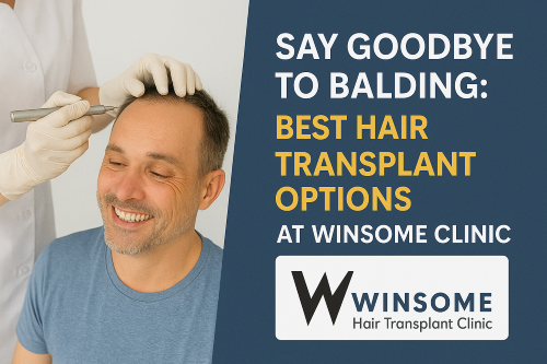 Best Hair Transplant Options